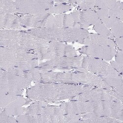 Invitrogen SLC22A6 Polyclonal Antibody 100 &mu;L; Unconjugated:Antibodies,