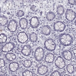 Invitrogen SLC22A6 Polyclonal Antibody 100 &mu;L; Unconjugated:Antibodies,