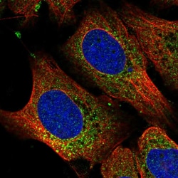 Invitrogen RPL11 Polyclonal Antibody 100 &mu;L; Unconjugated:Antibodies,