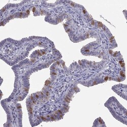 Invitrogen LRRC46 Polyclonal Antibody 100 &mu;L; Unconjugated:Antibodies,