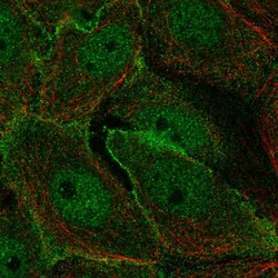 Invitrogen MARK2 Polyclonal Antibody 100 &mu;L; Unconjugated:Antibodies,