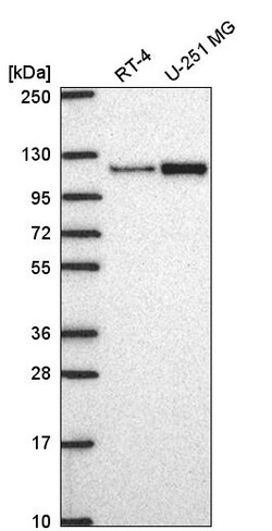 Invitrogen MTHFD1L Polyclonal Antibody 100 &mu;L | Buy Online | Invitrogen&trade; | Fisher Scientific