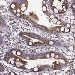 Invitrogen PLEKHB2 Polyclonal Antibody 100 &mu;L; Unconjugated:Antibodies,