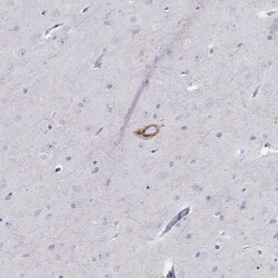 Invitrogen Chromogranin C Polyclonal Antibody 100 &mu;L; Unconjugated:Antikörper