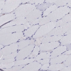 Invitrogen Chromogranin C Polyclonal Antibody 100 &mu;L; Unconjugated:Antikörper