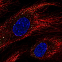 Invitrogen BCL6B Polyclonal Antibody 100 &mu;L; Unconjugated:Antibodies,