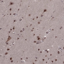 Invitrogen PTOV1 Polyclonal Antibody 100 &mu;L; Unconjugated:Antibodies,