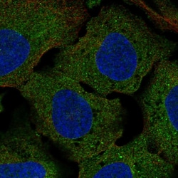 Invitrogen CLUL1 Polyclonal Antibody 100 &mu;L; Unconjugated:Antibodies,