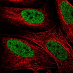 Invitrogen ZMYM3 Polyclonal Antibody 100 &mu;L; Unconjugated:Antibodies,