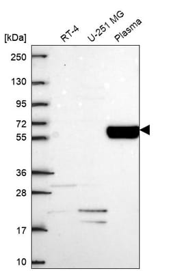 Invitrogen COL9A2 Polyclonal Antibody 100 &mu;L; Unconjugated:Antibodies,