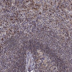 Invitrogen MTSS1 Polyclonal Antibody 100 &mu;L; Unconjugated:Antibodies,