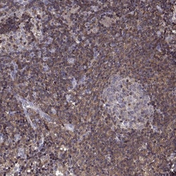 Invitrogen CENTB1 Polyclonal Antibody 100 &mu;L; Unconjugated:Antibodies,