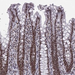 Invitrogen SNRPB2 Polyclonal Antibody 100 &mu;L; Unconjugated:Antibodies,