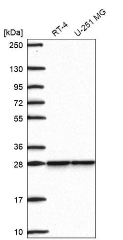 Invitrogen SNRPB2 Polyclonal Antibody 100 &mu;L; Unconjugated:Antibodies,