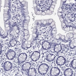Invitrogen SLC30A8 Polyclonal Antibody 100 &mu;L; Unconjugated:Antibodies,