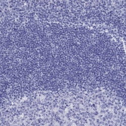 Invitrogen SLC30A8 Polyclonal Antibody 100 &mu;L; Unconjugated:Antibodies,