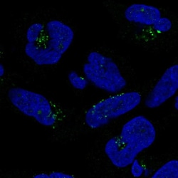 Invitrogen DPH5 Polyclonal Antibody 100 &mu;L; Unconjugated:Antibodies,