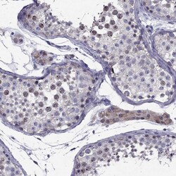 Invitrogen Norepinephrine Transporter Polyclonal Antibody 100 &mu;L; Unconjugated:Antibodies,