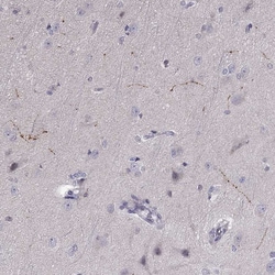 Invitrogen Norepinephrine Transporter Polyclonal Antibody 100 &mu;L | Buy Online | Invitrogen&trade; | Fisher Scientific