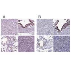 Invitrogen DRIL1 Polyclonal Antibody 100 &mu;L | Buy Online | Invitrogen&trade; | Fisher Scientific