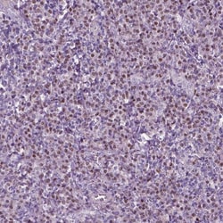 Invitrogen DRIL1 Polyclonal Antibody 100 &mu;L; Unconjugated:Antibodies,