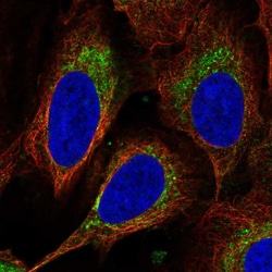 Invitrogen DEGS1 Polyclonal Antibody 100 &mu;L; Unconjugated:Antibodies,