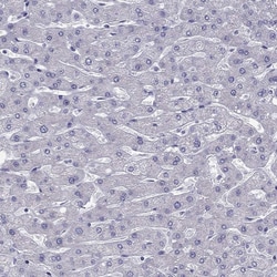 Invitrogen ZNF541 Polyclonal Antibody 100 &mu;L; Unconjugated:Antibodies,