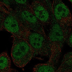Invitrogen RNF113A Polyclonal Antibody 100 &mu;L; Unconjugated:Antibodies,