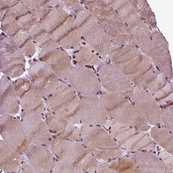 Invitrogen HEYL Polyclonal Antibody 100 &mu;L; Unconjugated:Antibodies,