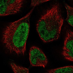 Invitrogen LCOR Polyclonal Antibody 100 &mu;L; Unconjugated:Antibodies,