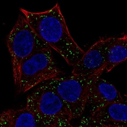Invitrogen ABT1 Polyclonal Antibody 100 &mu;L; Unconjugated:Antibodies,