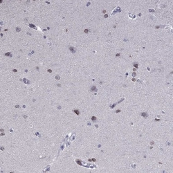 Invitrogen PRR18 Polyclonal Antibody 100 &mu;L; Unconjugated:Antibodies,