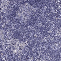 Invitrogen PRR18 Polyclonal Antibody 100 &mu;L; Unconjugated:Antibodies,
