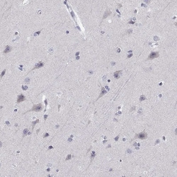 Invitrogen DOK3 Polyclonal Antibody 100 &mu;L; Unconjugated:Antibodies,