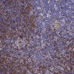 Invitrogen DOK3 Polyclonal Antibody 100 &mu;L; Unconjugated:Antibodies,