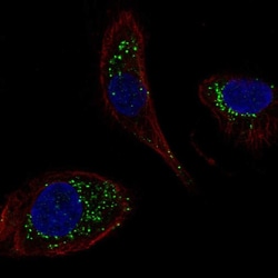 Invitrogen DNAJC5B Polyclonal Antibody 100 &mu;L; Unconjugated:Antibodies,
