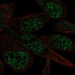 Invitrogen ZNF273 Polyclonal Antibody 100 &mu;L; Unconjugated:Antibodies,