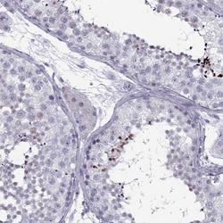 Invitrogen DMRT3 Polyclonal Antibody 100 &mu;L; Unconjugated:Antibodies,