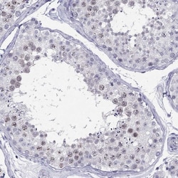 Invitrogen C11orf63 Polyclonal Antibody 100 &mu;L; Unconjugated:Antibodies,