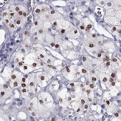Invitrogen PHOX2A Polyclonal Antibody 100 &mu;L; Unconjugated:Antibodies,