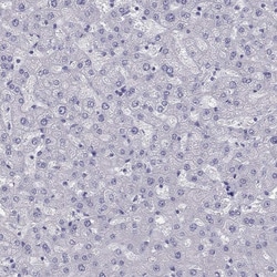 Invitrogen PHOX2A Polyclonal Antibody 100 &mu;L; Unconjugated:Antibodies,