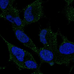 Invitrogen ARHGDIG Polyclonal Antibody 100 &mu;L | Buy Online | Invitrogen&trade; | Fisher Scientific
