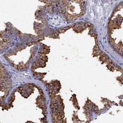 Invitrogen CPNE4 Polyclonal Antibody 100 &mu;L; Unconjugated:Antibodies,