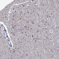 Invitrogen Kir4.1 (KCNJ10) Polyclonal Antibody 100 &mu;L; Unconjugated:Antibodies,