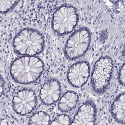Invitrogen Kir4.1 (KCNJ10) Polyclonal Antibody 100 &mu;L; Unconjugated:Antibodies,