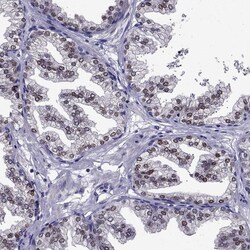 Invitrogen Nkx3.1 Polyclonal Antibody 100 &mu;L | Buy Online | Invitrogen&trade; | Fisher Scientific