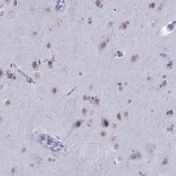 Invitrogen TBR1 Polyclonal Antibody 100 &mu;L; Unconjugated:Antibodies,