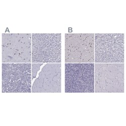 Invitrogen TBR1 Polyclonal Antibody 100 &mu;L; Unconjugated:Antibodies,