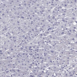 Invitrogen TBR1 Polyclonal Antibody 100 &mu;L; Unconjugated:Antibodies,