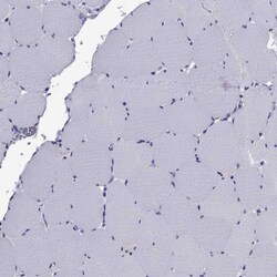 Invitrogen TBR1 Polyclonal Antibody 100 &mu;L; Unconjugated:Antibodies,